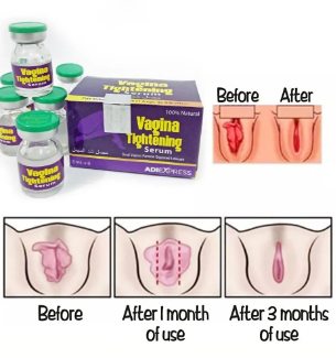 Vagin Gel Tightening Cream for Women